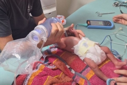 Pénurie de soins en Nouvelle-Calédonie : un bébé prématuré naît dans des conditions extrêmes en province Nord