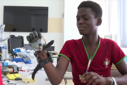 Deux adolescents  bénéficient des premières prothèses myoélectriques posées en Guyane