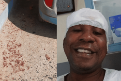 Après son agression, il veut "montrer la réalité de ce qui se passe à Mayotte"