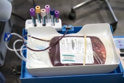 Le nouveau groupe sanguin "Gwada négatif" suscite des espoirs pour la recherche scientifique
