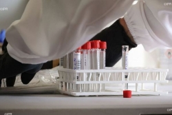 Chikungunya à La Réunion : une étude lancée pour estimer le nombre de personnes infectées