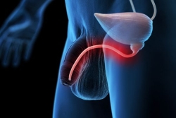 Cancer de la prostate : "adopter des réflexes simples mais essentiels" pour anticiper la maladie