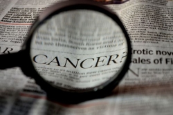 Cancer : vers une inclusion des populations ultramarines dans les essais cliniques ?