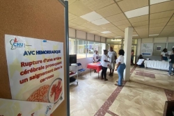 L’Accident vasculaire cérébral (AVC), première cause de mortalité en Guyane