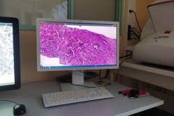 Diagnostic du cancer : l’Outre-mer en quête de solutions numériques face à la pénurie de pathologistes