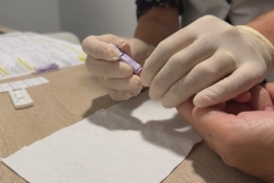 309 personnes vivent avec le VIH en Nouvelle-Calédonie