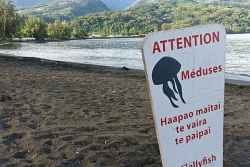 Un enfant piqué par des méduses à la pointe Vénus