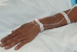 Coup d’envoi officiel pour le registre national des cancers