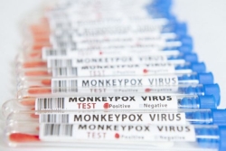 Encore deux nouveaux cas de variole Mpox confirmés à La Réunion, soit 6 depuis le début de l'année