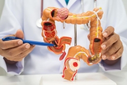 « Mars Bleu », mois de sensibilisation au dépistage du cancer colorectal : 180 à 200 nouveaux cas par an en Martinique 