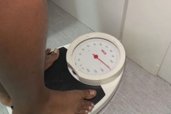 L’obésité, un frein dans la lutte contre les maladies non transmissibles, comme le cancer