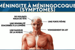 Signalement d'un cas d'infection invasive à méningocoque à Tahiti
