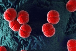 Sixième infection à méningocoque à Tahiti en 2026, surveillance renforcée sur l'île