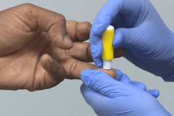Mayotte : la peur des expulsions éloigne les malades du VIH des soins